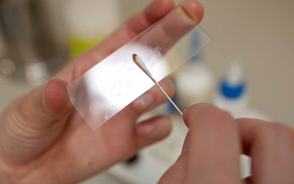 grattage pour la présence de parasites dans le corps