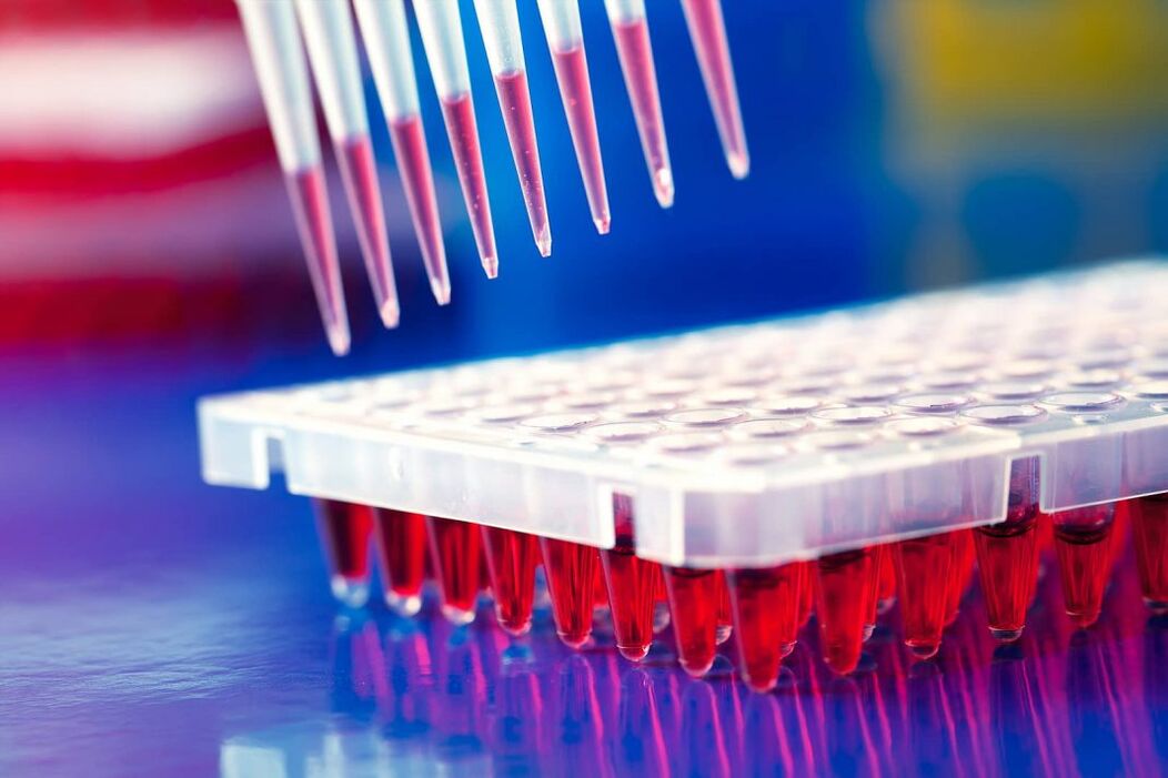 test sanguin immunologique pour les parasites