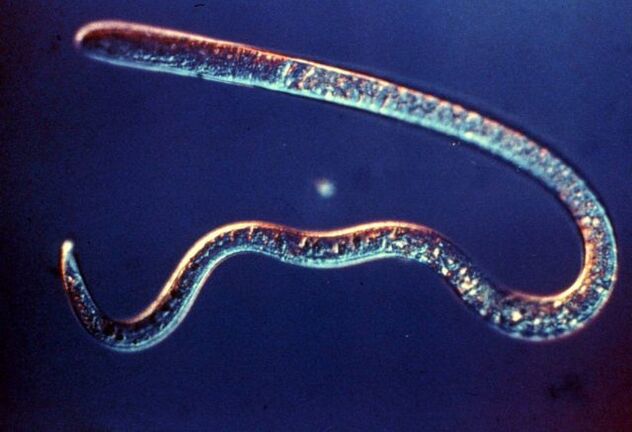 trichinella du corps humain